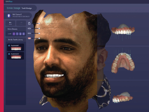 KOFL setzt auf digitale Innovation: Gesichtsscanner im Einsatz seit dem ersten Tag